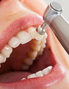 Limpieza Dental