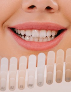 Blanqueamiento dental